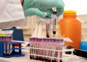 Una gestión con 'parches' que no protege la salud en el deporte